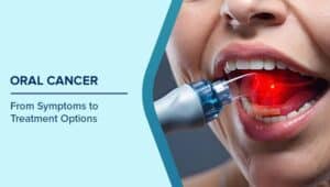 Oral Cancer