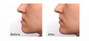 Oral and maxillofacial surgery