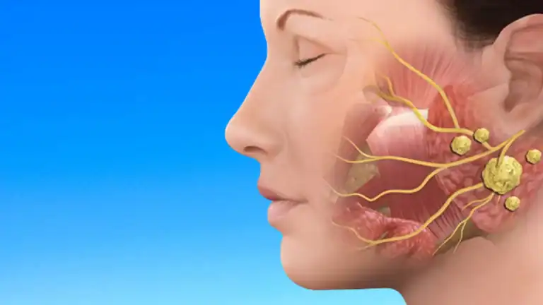 salivary gland stone treatment