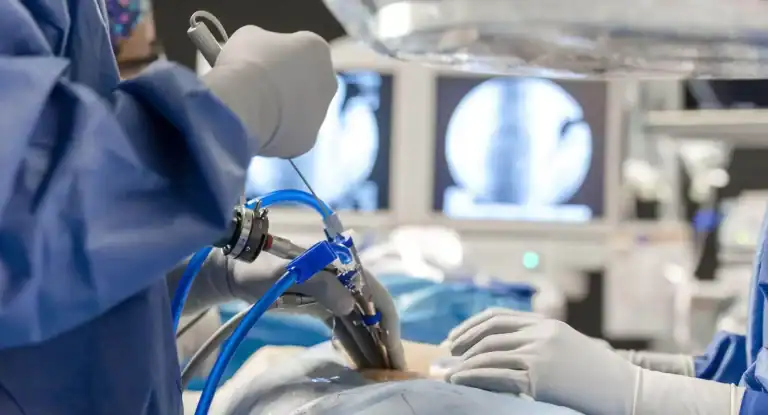 endoscopic spine surgery