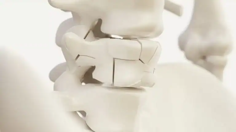 vertebral compression fracture treatment
