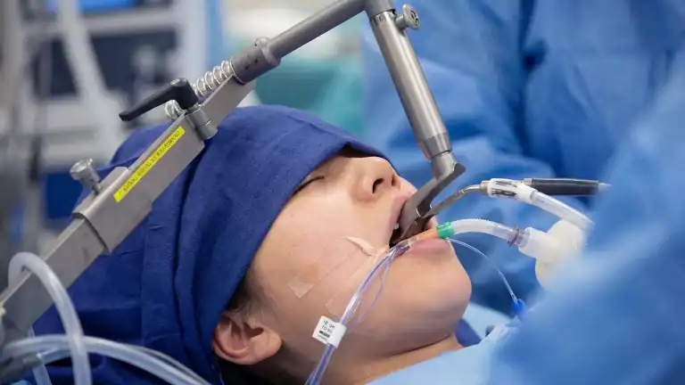 vocal cord surgery
